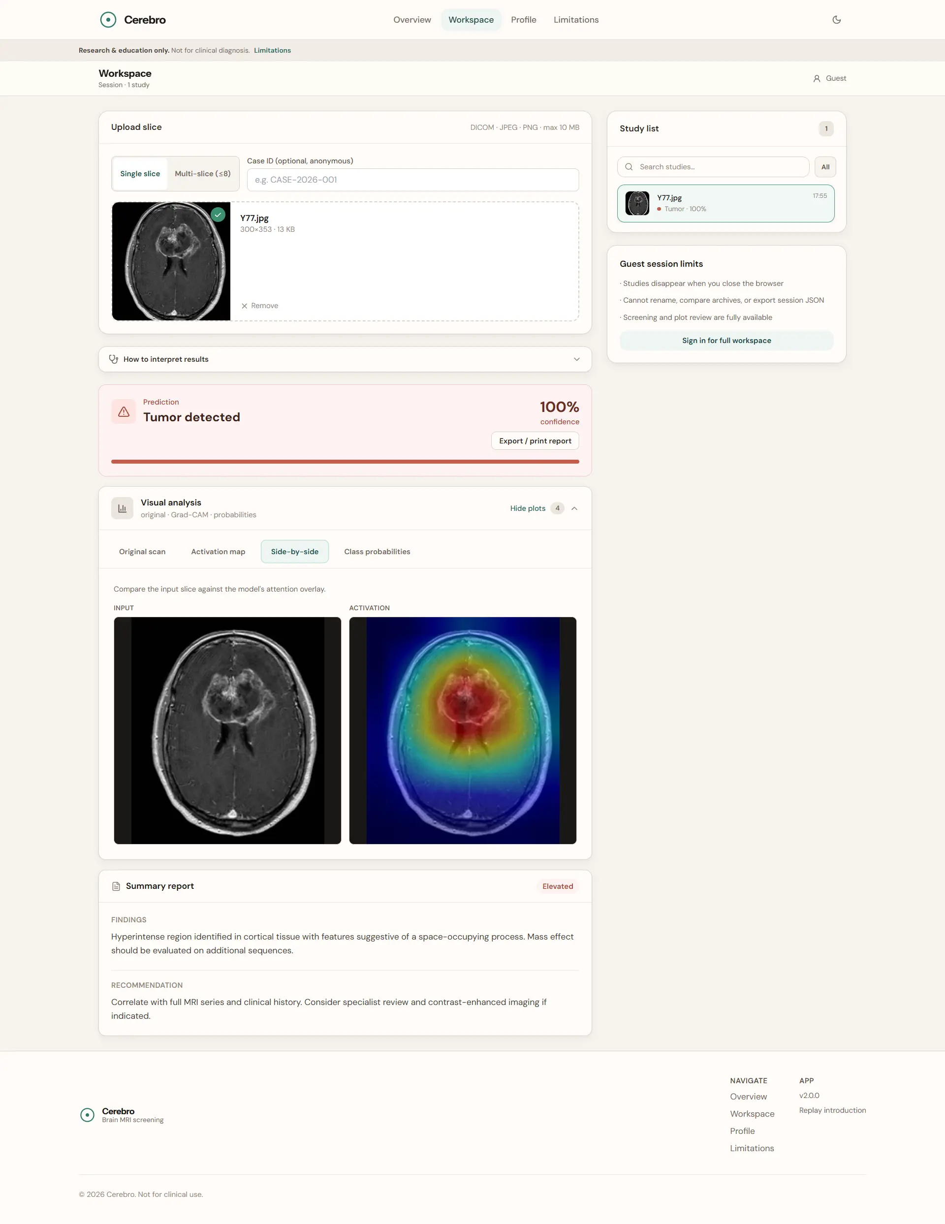 Cerebro - Brain MRI Screening