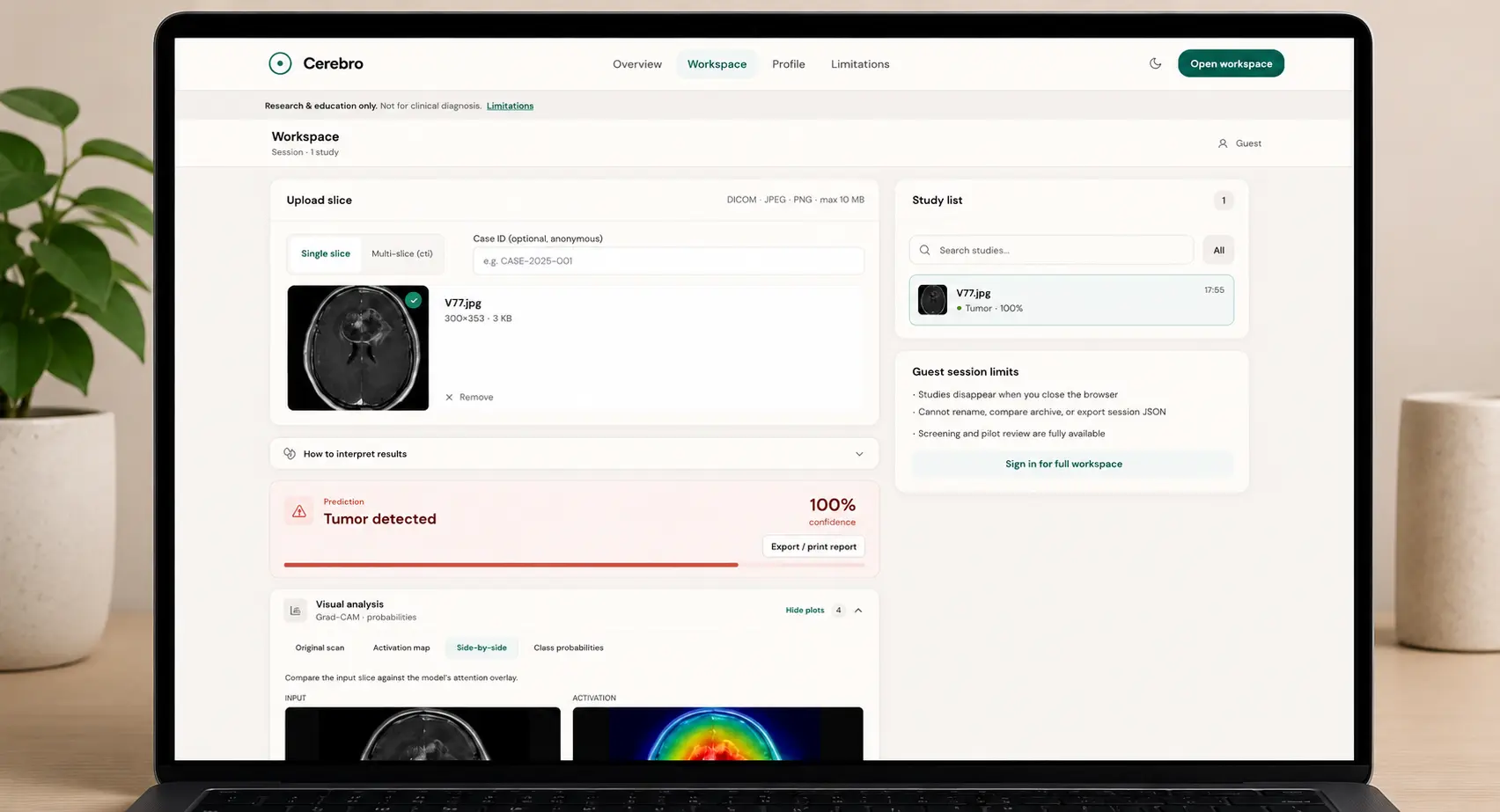 Cerebro - Brain MRI Screening